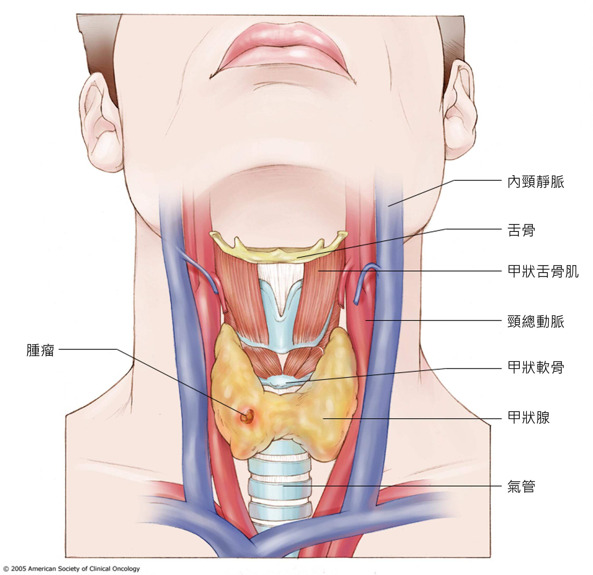 舌骨 H 簡易醫學字典 認識癌症 華人癌症資訊網 舌骨 H 簡易醫學字典 認識癌症 華人癌症資訊網